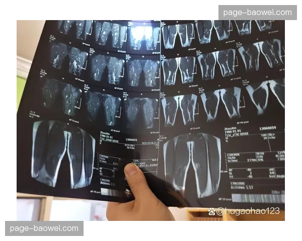 武汉三镇贝维斯第36分钟伤退 核磁检查确认股二头肌损伤